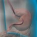 Image of Gastroenterológia alebo gastroskopia: postup a vlastnosti „hadice do krku“