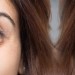 Image of Korekcia očných viečok omladí váš vzhľad