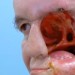 Image of Muž mal 4 roky polovicu tváre a dieru v hlave, pomohla mu 3D tlačiareň