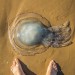 Image of Prvá pomoc pri popálení medúzou - čo zaberá a rýchla pomoc