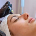 Image of V&nbsp;zime je ten spr&aacute;vny čas na mezoterapiu a&nbsp;chemick&yacute; peeling | News.sk